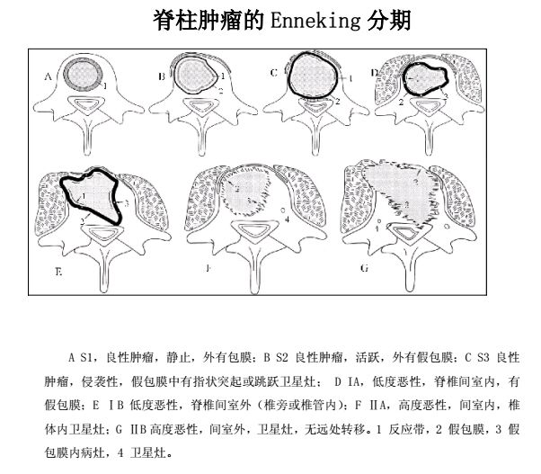 ENNEKING分期.jpg