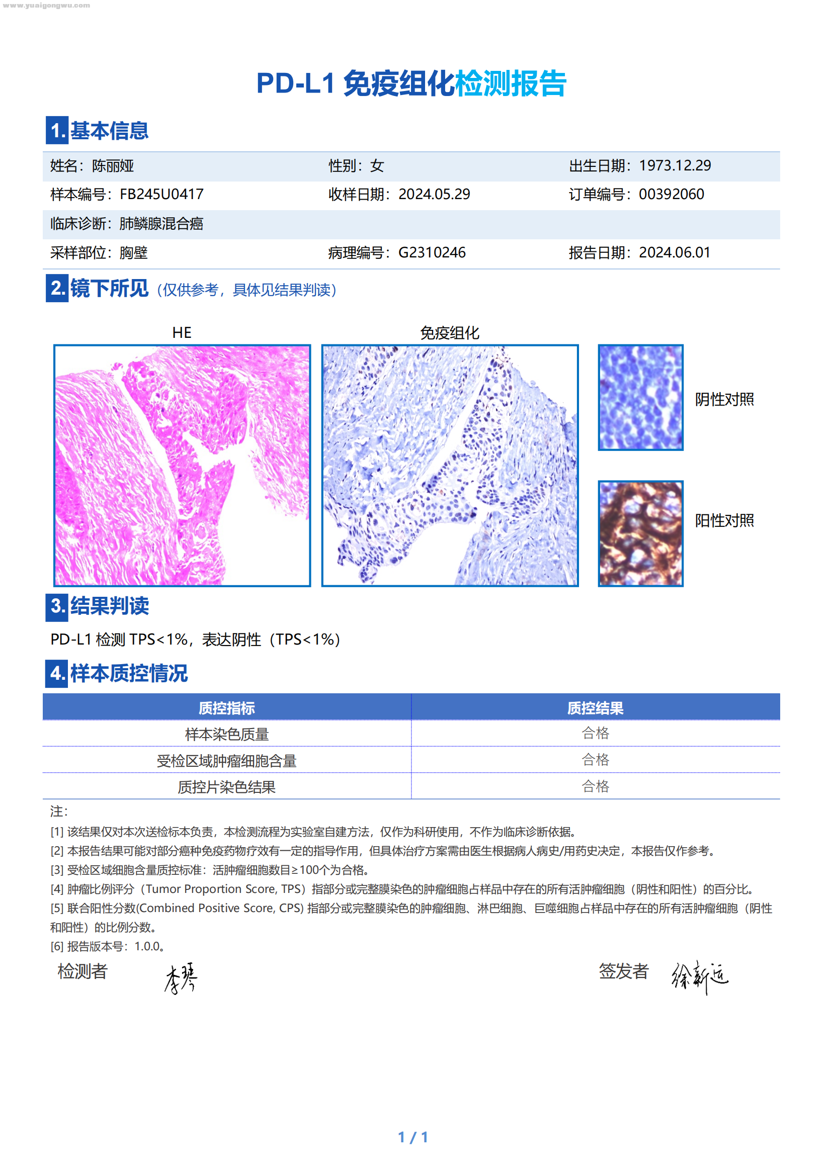 2024.06.01-陈丽娅-00392060-FB245U0417-D-免疫组化检测报告(1)_00.png